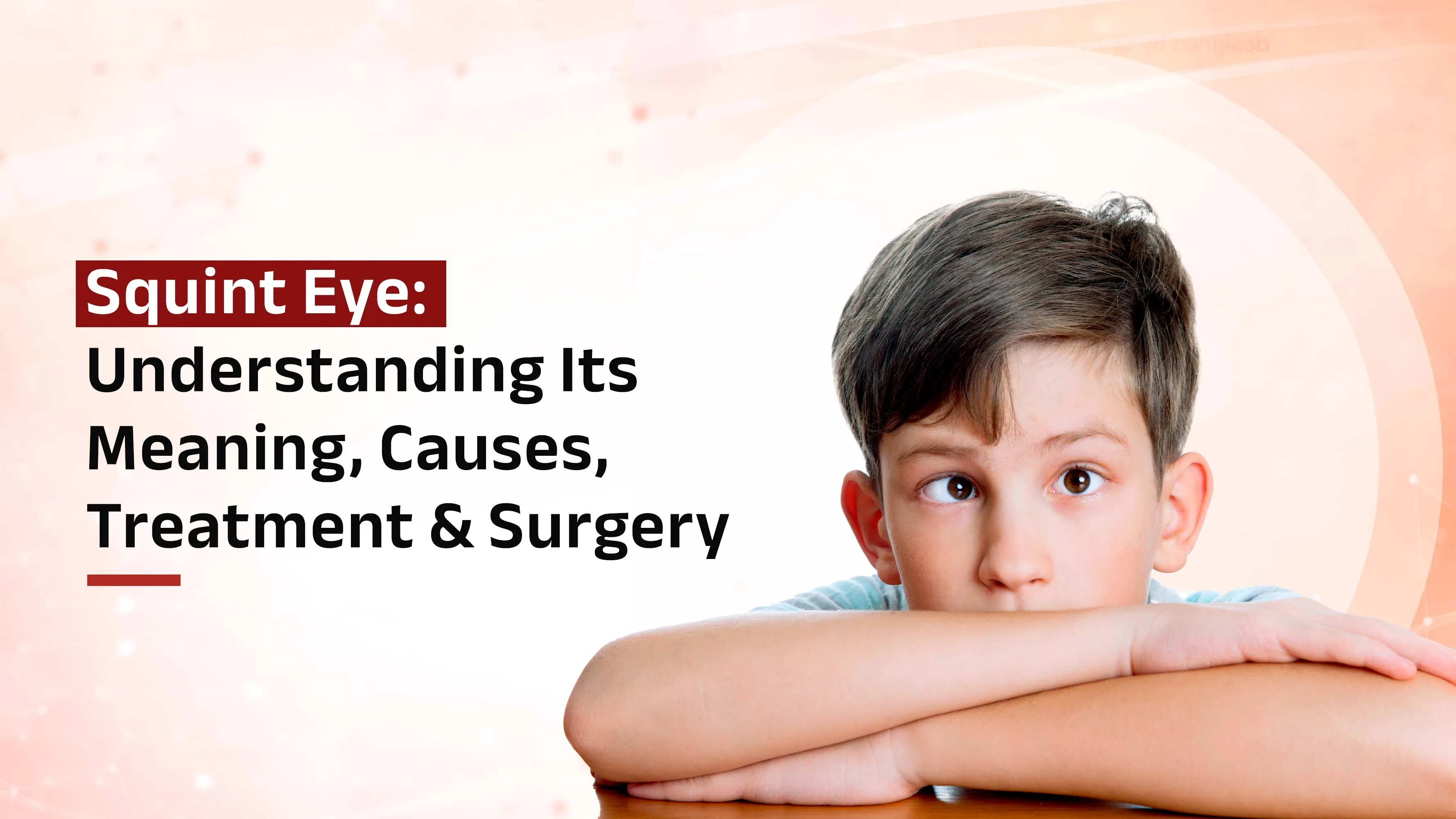 Squint Eye Surgery